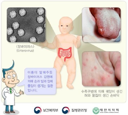 충북보건환경연구원, 여름철 물놀이장 대상 급성 호흡기 바이러스 및 수족구병 실태조사 실시